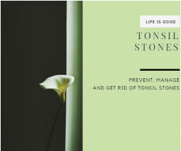 Tonsil Stones (video) + 25 Articles FREE