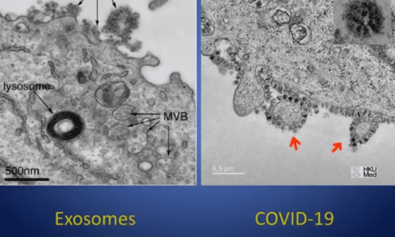 Exosomes Theory Covid