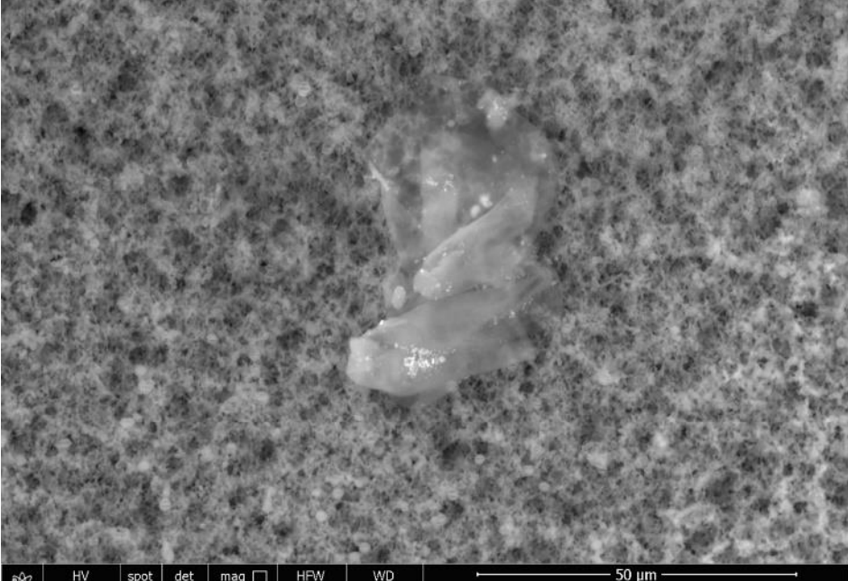 fig 17 Scanning & transmission electron microscopy reveals graphene oxide in Covid-19 vaccines (33 photos)