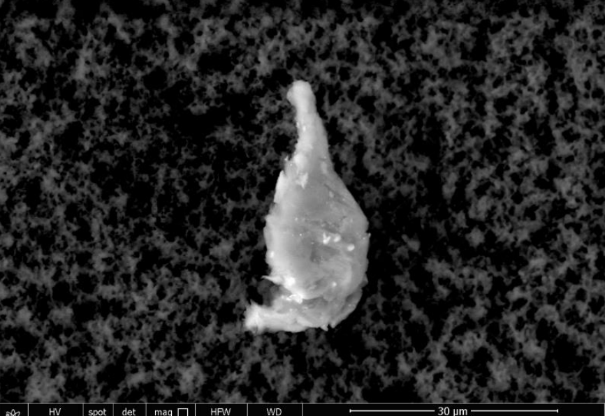 fig 27 Scanning & transmission electron microscopy reveals graphene oxide in Covid-19 vaccines (33 photos)