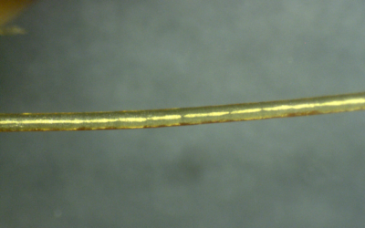 Nanowire clot 200x.png Microscopy photos of clot structures extracted from those who “suddenly died” (SADS)